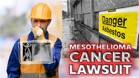 Its important to find your voice and learn how to navigate the sometimes murky waters. . Brookfield mesothelioma legal question